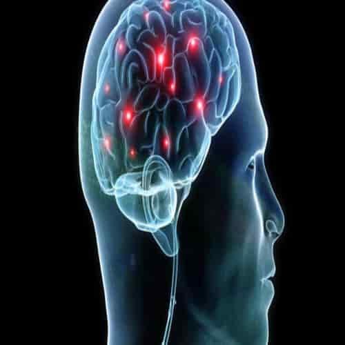 Sindrom Savant Kapasitas Kecerdasan Otak Luar Biasa