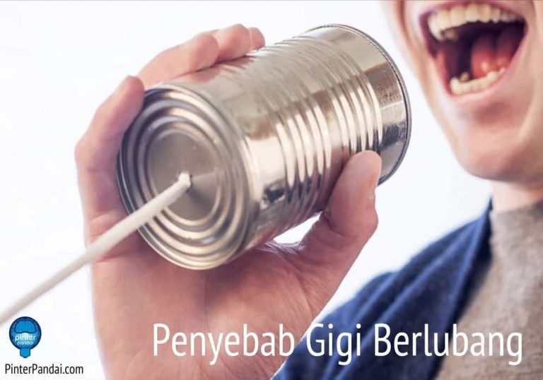 Penyebab Gigi Berlubang | 10 Penyebab Gigi Berlubang