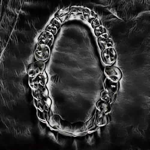 Gesekan gigi dapat diproteksi gigi plastik