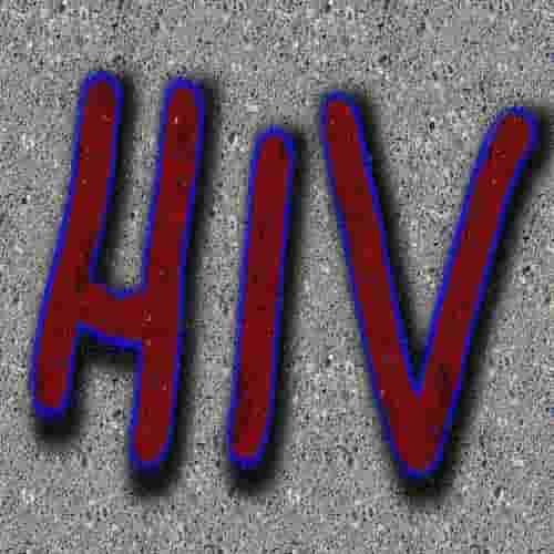 Tanda dan gejala HIV