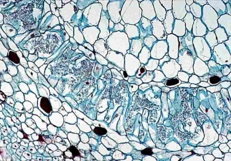 Mikrobiota Pada Manusia, Hewan, Dan Tumbuhan - Penjelasan Dan Contoh