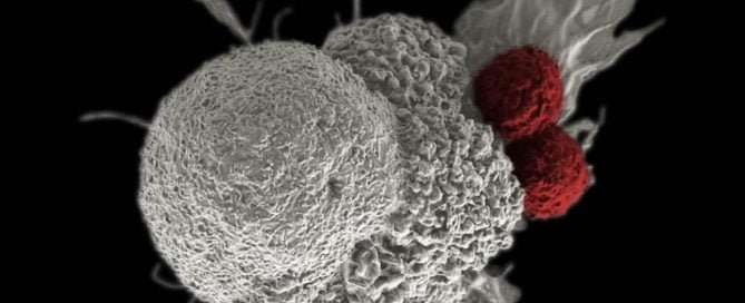 Imunoterapi Pengobatan Kanker | Jenis, Untuk Menerima, Efek samping
